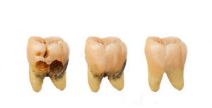 ¿Cuál es la pasta de dientes correcta para mi hijo?