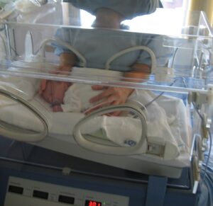 alimentación de un bebé prematuro